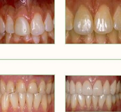 Grandview Family Dental Logo