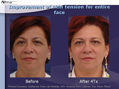 Accent Face and Body Image