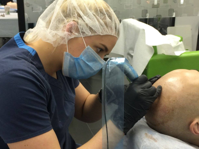 Micro Scalp Design Image