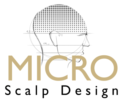 Micro Scalp Design Image