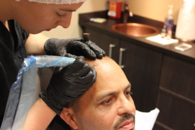 Micro Scalp Design Image