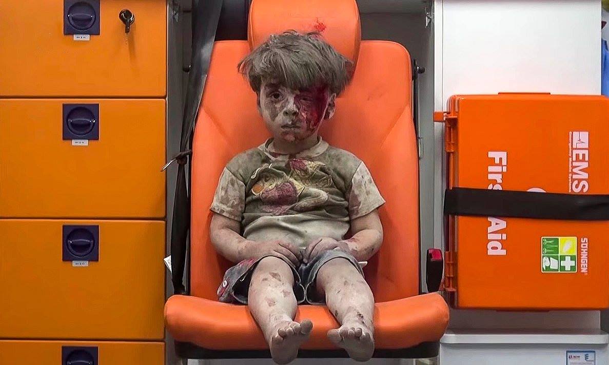 Omran rescued from a Russian airstrike