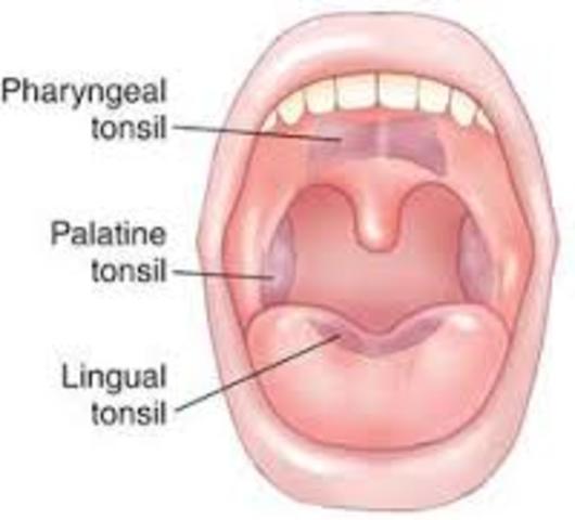 Tonsils Removed
