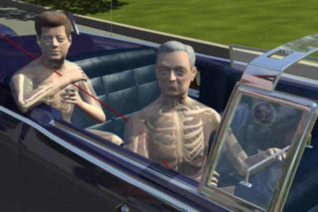 Assassination of JFK