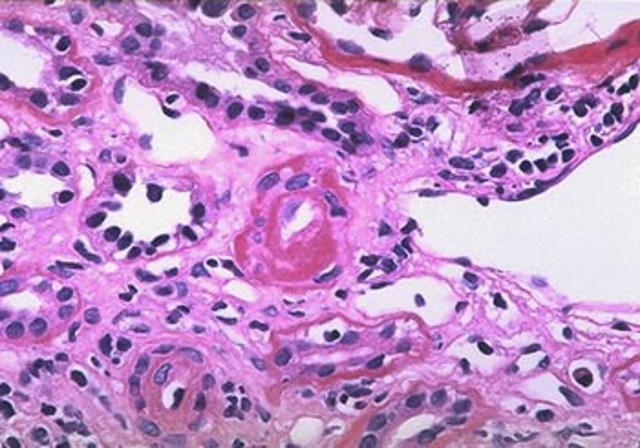 Resultados patología