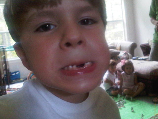 Lost first tooth