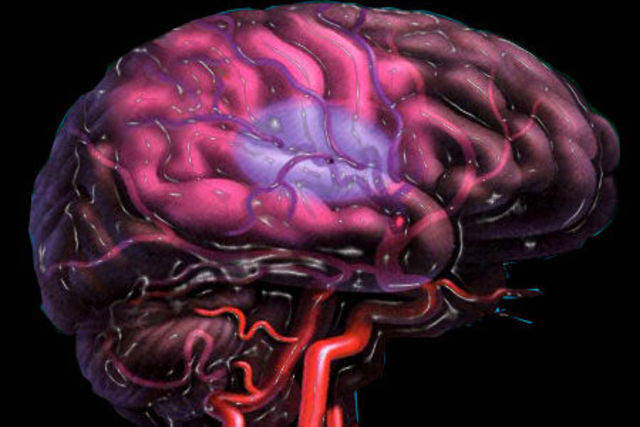 Surgen remedios contra los coágulos cerebrales