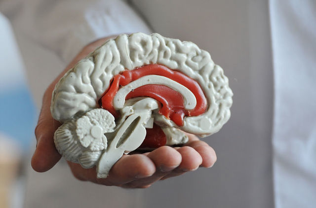 Primer atlas del cerebro humano disponible en internet