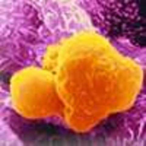 I Became Aware of GcMAF