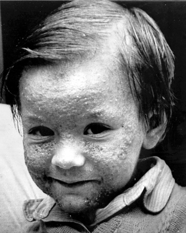 Nube toxica de Séveso.