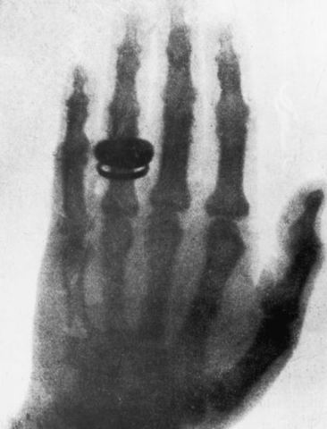 Discovery of X-Rays