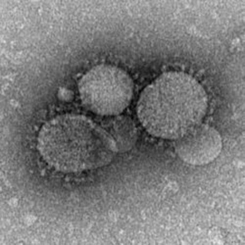 Novel coronavirus infection (Middle East respiratory syndrome-coronavirus)