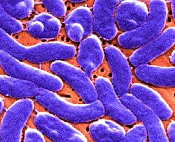 The Germ Theory of Disease is published