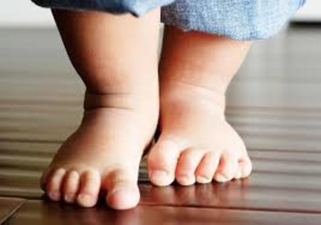 Aprender a caminar