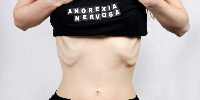 Anorexia ( 1800- La anorexia se vuelve más constante y ocurrente)