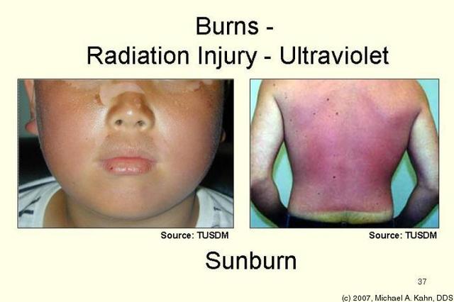 Segundo accidente-terac 25
