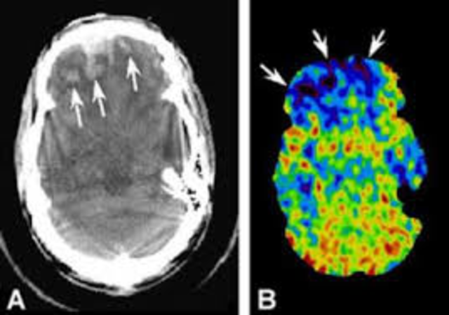 Radionuclides