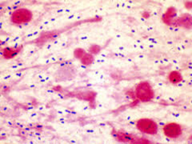 apareceron as primeiras bacterias.