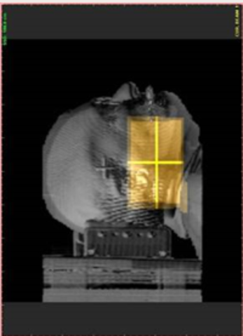 Quinto accidente-terac 25