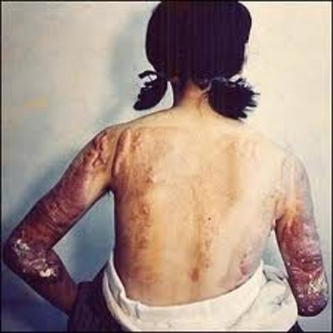 Primer Accidente: Marietta Georgia, Kennestone Regional Oncology Center