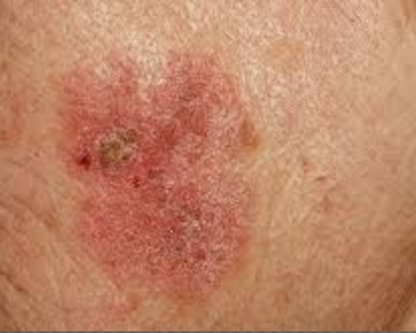 Sexto accidente-terac 25