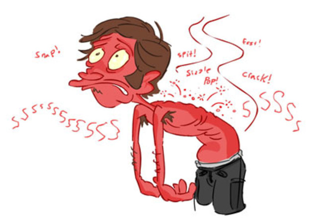 accidente 04 - Therac-25