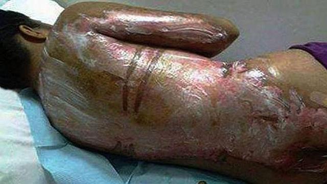 Sexto Accidente: Yakima Valley Memorial Hospital