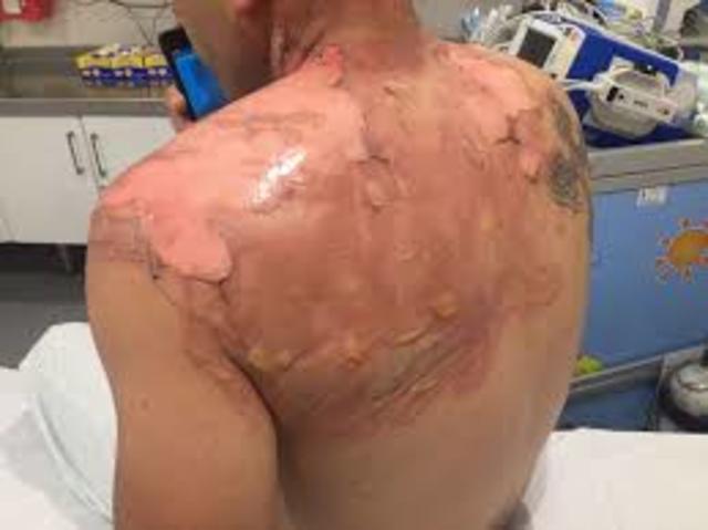 Cuarto Accidente: Texas 1986