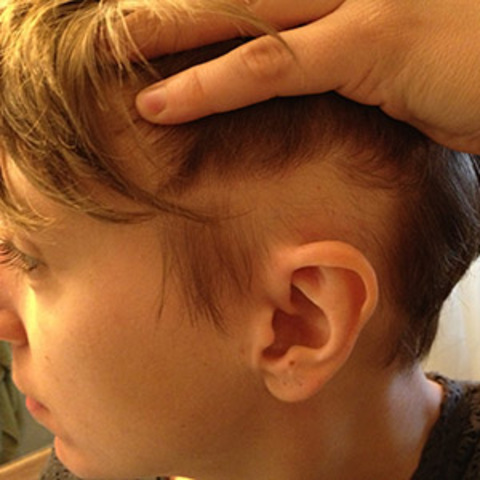 beginning of steriods