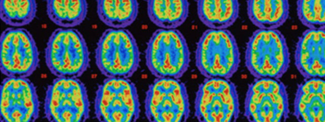 Alzheimer's Association International Conference®