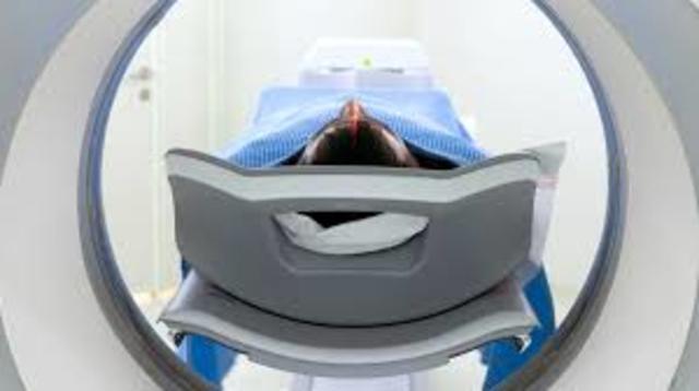 La creación del therac 25