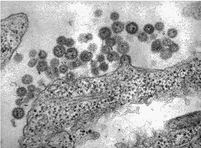 Djamel Tahi interviewed Dr. Charles Dauguet, Electron Microscopist