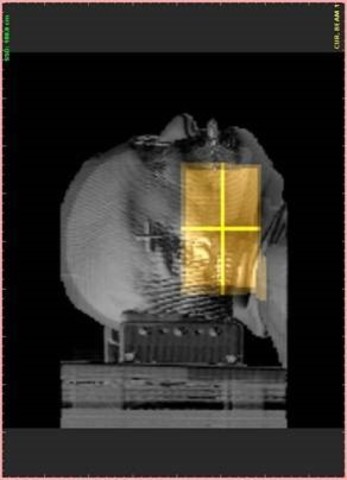 April 1986 caso Tyler