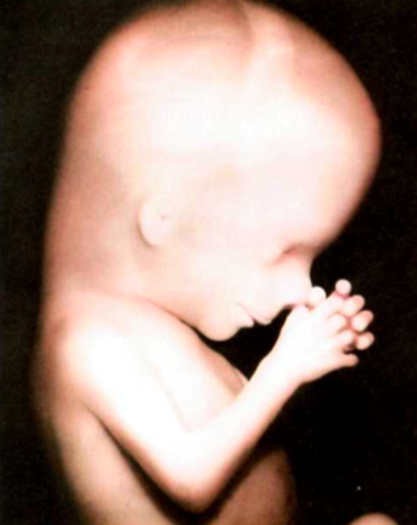 11 semana - término (38 semanas aprox)