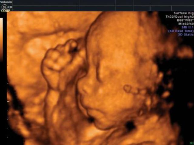 NO SIEMPRE "MÁS ES MEJOR"...