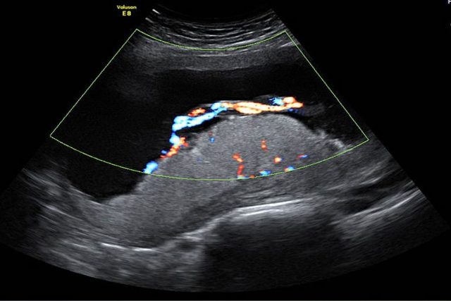 EVALUACIÓN INTEGRAL