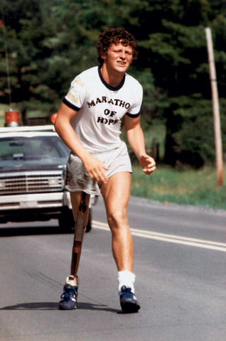 8. előadás Csont daganatok