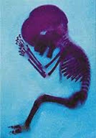 Periodo Fetal Semana 9