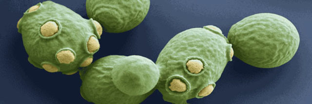 Secuencia completa de un eucariota.