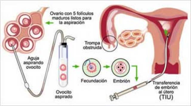 Fecundación artificial.