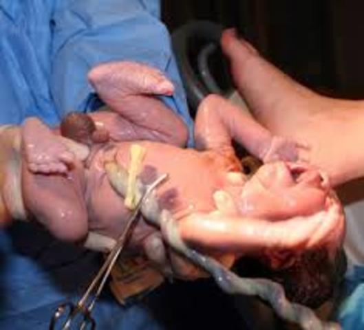 Semana cuarenta "Parto"