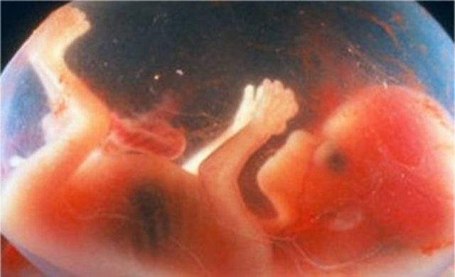 Elongación y enderezamiento del tronco(Día 46 a 51)