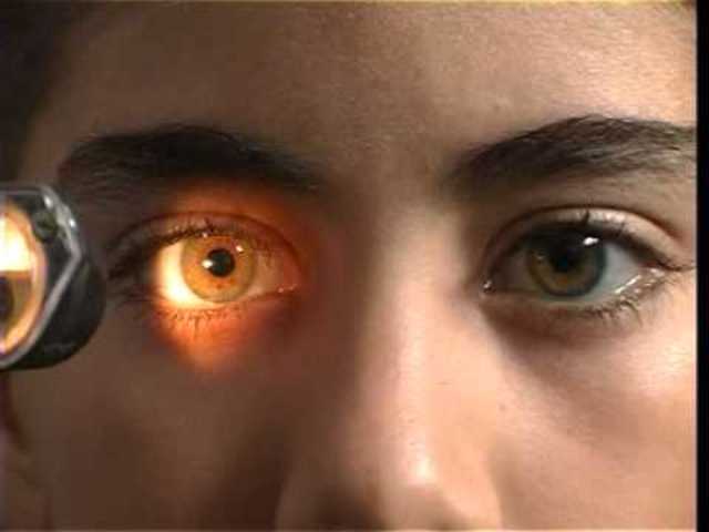 Ojos presentan reflejo fotomotor