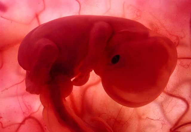 Periodo fetal. Tercer mes