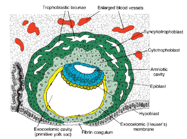 Implatación (aparición de lagunas)