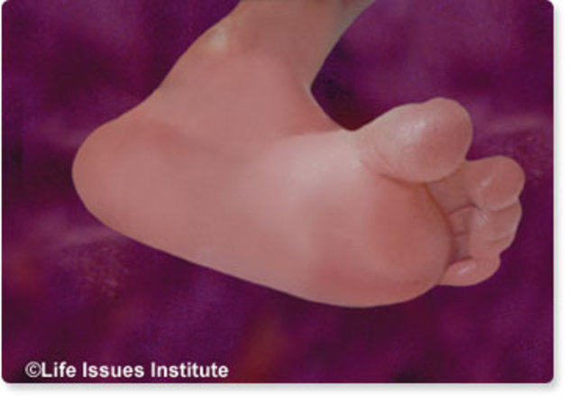 Semana 17 De Gestación