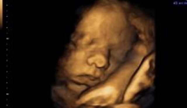 30 Semanas de Gestación