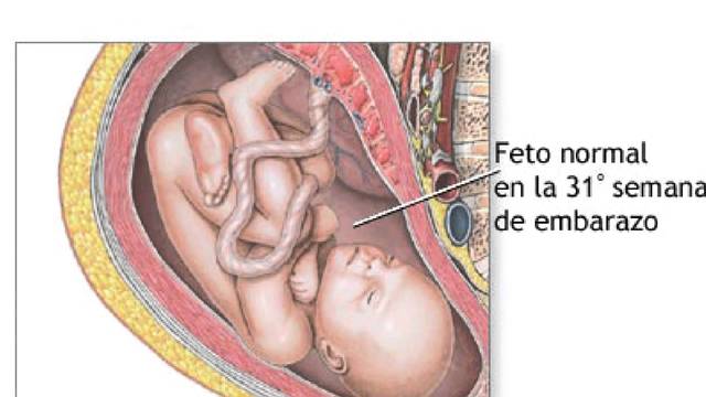 31 Semanas de Gestación