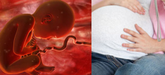 34 Semanas de Gestación