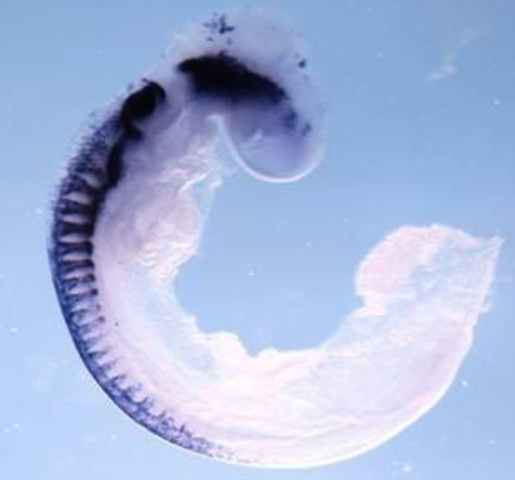 Semana 4: neurulación